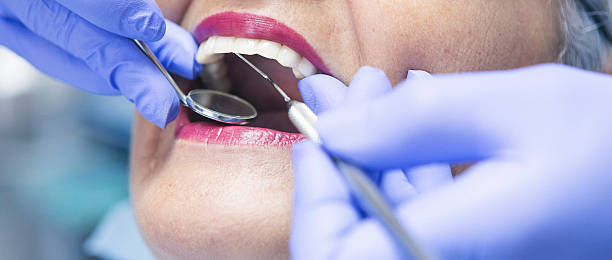 Best Urgent Care for Lost Fillings or Crowns in Wolf Lake, MI